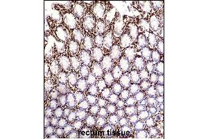 VIME Antibody (ABIN652639 and ABIN2842429) immunohistochemistry analysis in formalin fixed and paraffin embedded human rectum tissue followed by peroxidase conjugation of the secondary antibody and DAB staining. (Vimentin 抗体)
