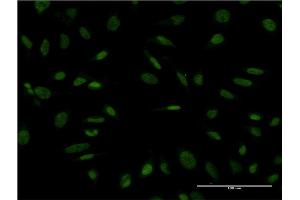 Immunofluorescence of monoclonal antibody to PROX1 on HeLa cell. (PROX1 抗体  (AA 638-737))