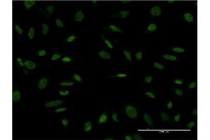 Immunofluorescence of monoclonal antibody to PROX1 on HeLa cell.