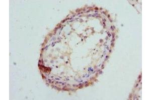 Immunohistochemistry of paraffin-embedded human testis tissue using ABIN7154163 at dilution of 1:100 (GPD2 抗体  (AA 25-325))