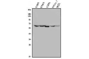 Western blot analysis of ME2 using anti-ME2 antibody (ABIN7600967).