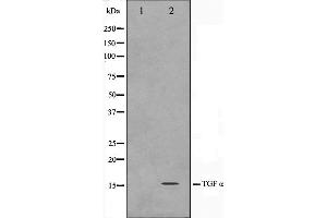 Western blot analysis on COS7 cell lysate using TGF alpha Antibody,The lane on the left is treated with the antigen-specific peptide. (TGFA 抗体)