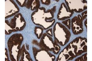 Image no. 1 for anti-Prostate Specific Antigen (PSA) antibody (ABIN1502668) (Prostate Specific Antigen 抗体)