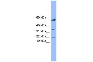 LYRM1 antibody used at 1 ug/ml to detect target protein. (LYRM1 抗体  (Middle Region))