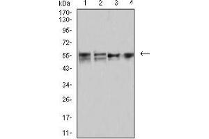 Western blot analysis using CD2 mouse mAb against MOLT4 (1), MCF-7 (2), Hela (3), and L1210 (4) cell lysate. (CD2 抗体  (AA 25-140))