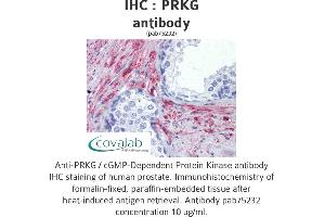 Image no. 2 for anti-PRKG antibody (ABIN1738352) (PRKG 抗体)