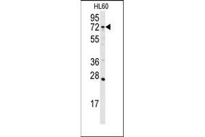 Image no. 1 for anti-Diacylglycerol Kinase, alpha 80kDa (DGKA) (C-Term) antibody (ABIN360612) (DGKA 抗体  (C-Term))