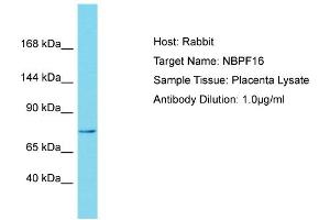 Host: Rabbit Target Name: NBPF15 Sample Tissue: Human Placenta Antibody Dilution: 1ug/ml