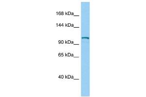 Host:  Rabbit  Target Name:  Dsg2  Sample Type:  Mouse Testis lysates  Antibody Dilution:  1. (Desmoglein 2 抗体  (Middle Region))