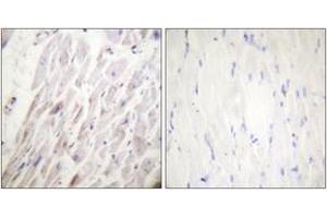 Immunohistochemistry analysis of paraffin-embedded human heart, using Dematin (Phospho-Ser403) Antibody. (Dematin 抗体  (pSer403))
