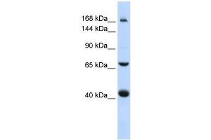 ABCC9 antibody used at 1 ug/ml to detect target protein. (ABCC9 抗体)