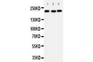 Western Blotting (WB) image for anti-Tumor Protein P53 Binding Protein 1 (TP53BP1) (AA 1955-1972), (C-Term) antibody (ABIN3044038)