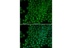 Immunofluorescence analysis of HeLa cells using POLR1C antibody. (POLR1C 抗体)