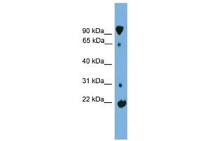 KLHL2 antibody used at 1 ug/ml to detect target protein. (KLHL2 抗体)