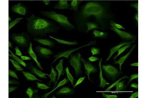 Immunofluorescence (IF) image for anti-Mitogen-Activated Protein Kinase 8 (MAPK8) (AA 1-384) antibody (ABIN519235)