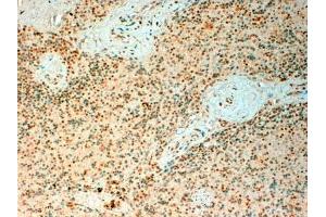 ABIN571057 (4µg/ml) staining of paraffin embedded Human Spleen. (TET2 抗体  (Internal Region))