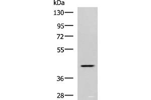 Western blot analysis of Hela cell lysate using SYT2 Polyclonal Antibody at dilution of 1:800 (SYT2 抗体)