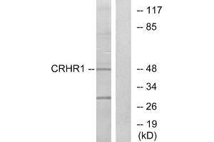 Western blot analysis of extracts from HT-29 cells, using CRHR1 antibody. (CRHR1 抗体  (Internal Region))