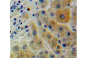 IHC-P analysis of Liver tissue, with DAB staining. (CD2AP 抗体  (AA 149-429))