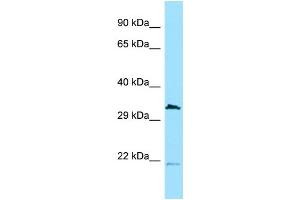 Western Blotting (WB) image for anti-Cell Division Cycle 37-Like 1 (CDC37L1) (N-Term) antibody (ABIN2789146) (CDC37L1 抗体  (N-Term))