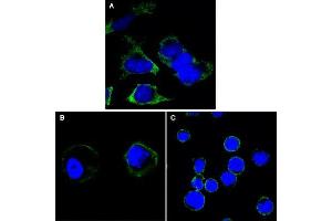Confocal immunofluorescence analysis of Hela (A), A431 (B) and THP-1 (C) cells using RTN3 antibody (green). (Reticulon 3 抗体)