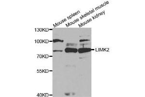Western blot analysis of extracts of various cell lines, using LIMK2 antibody. (LIMK2 抗体  (AA 1-240))