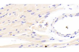 Immunohistochemistry (IHC) image for anti-Succinate Dehydrogenase Complex, Subunit A, Flavoprotein (Fp) (SDHA) (AA 4-300) antibody (ABIN7441595)