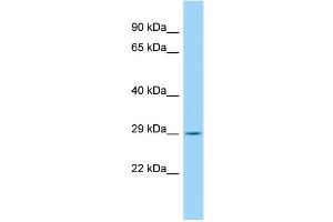 Host: Rabbit Target Name: CCDC134 Sample Type: Fetal Kidney lysates Antibody Dilution: 1. (CCDC134 抗体  (C-Term))
