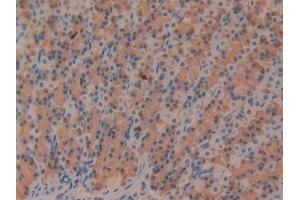 DAB staining on IHC-P; Samples: Rat Stomach Tissue (Fibrillin 1 抗体  (AA 1475-1638))