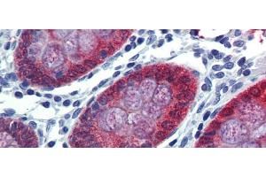 Rabbit Anti-HOXC8 Antibody Catalog Number: arp39557 Paraffin Embedded Tissue: Human Colon Antibody Concentration: 5 ug/ml (HOXC8 抗体  (N-Term))