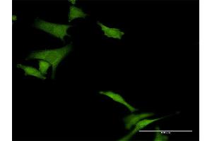 Immunofluorescence of purified MaxPab antibody to HABP4 on HeLa cell. (HABP4 抗体  (AA 1-308))