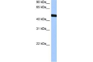 WB Suggested Anti-TBX20 Antibody Titration:  0. (TBX20 抗体  (Middle Region))