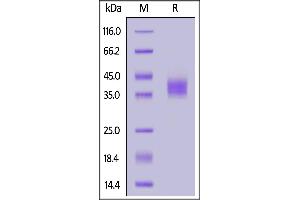 Human Tissue Factor, His Tag on  under reducing (R) condition. (Tissue factor Protein (AA 33-251) (His tag))