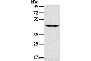 Western blot analysis of Human fetal brain tissue, using SLC16A8 Polyclonal Antibody at dilution of 1:200 (MCT3 抗体)