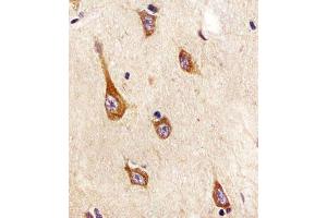 (ABIN652381 and ABIN2841827) staining TrkA in human brain tissue sections by Immunohistochemistry (IHC-P - paraformaldehyde-fixed, paraffin-embedded sections). (TrkA-pY791 (AA 769-796) 抗体)