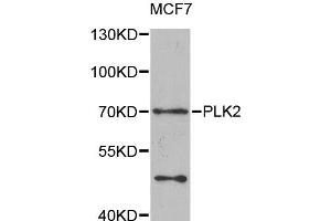 Western blot analysis of extracts of MCF-7 cells, using PLK2 antibody (ABIN5975471) at 1/1000 dilution. (PLK2 抗体)