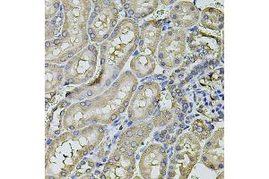 Immunohistochemistry of paraffin-embedded rat kidney using FDX1 antibody. (Ferredoxin1 (FDX1) 抗体)
