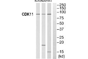 Western blot analysis of extracts from HUVEC cells, HepG2 cells and CoLo cells, using CDK11 antibody. (CDK11 抗体  (Internal Region))