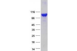 Western Blotting (WB) image for EPS8-Like 1 (EPS8L1) (Transcript Variant 1) protein (Myc-DYKDDDDK Tag) (ABIN2720342)