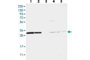 Western blot analysis of Lane 1: RT-4, Lane 2: U-251 MG, Lane 3: Human Plasma, Lane 4: Liver, Lane 5: Tonsil with TATDN1 polyclonal antibody .