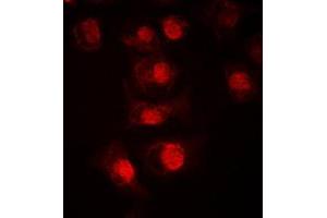 Immunofluorescent analysis of TCFL4 staining in LOVO cells. (MLX 抗体  (Center))