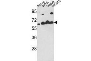 Image no. 1 for anti-Calreticulin (CALR) (Middle Region) antibody (ABIN452803) (Calreticulin 抗体  (Middle Region))