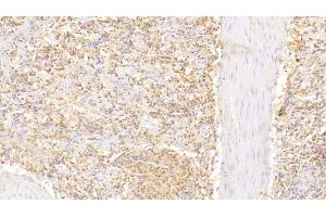 Detection of MSN in Human Spleen Tissue using Polyclonal Antibody to Moesin (MSN) (Moesin 抗体  (AA 354-577))