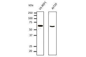 Anti-myc tag Ab at 1/1,000 dilution, 293 cells transfected With myc-mCherry (red fluorescent protein), rabbit polyclonal to goat lµg (HRP) at 1/10,000 dilution, (CHM 抗体  (AA 1-80))