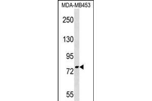 PNPT1 Antibody (Center) (ABIN1538242 and ABIN2849157) western blot analysis in MDA-M cell line lysates (35 μg/lane). (PNPT1 抗体  (AA 284-311))