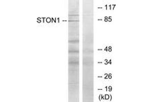 Western blot analysis of extracts from K562 cells, using STON1 Antibody. (STON1 抗体  (AA 686-735))