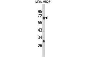Western blot analysis of GIPR Antibody (Center) in MDA-MB231 cell line lysates (35ug/lane). (GIPR 抗体  (Middle Region))