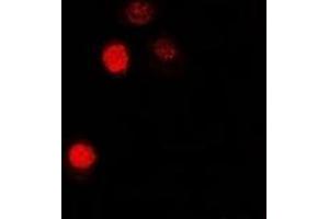 Immunofluorescent analysis of MATH-1 staining in U2OS cells. (ATOH1 抗体)