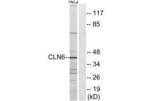Western blot analysis of extracts from HeLa cells, using CLN6 antibody. (CLN6 抗体)
