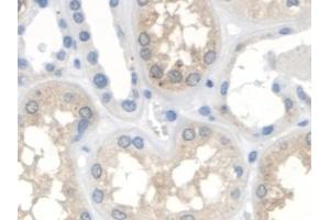 Immunohistochemistry (IHC) image for anti-3-Oxoacid CoA Transferase 1 (OXCT1) (AA 40-489) antibody (ABIN7441481)